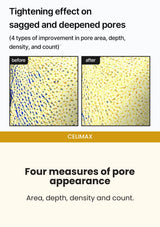 CELIMAX Pore + Dark Spot Brightening Cream — Four measures of pore appearance