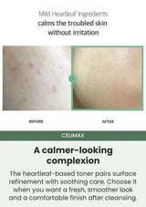 CELIMAX Smooth without neglecting comfort: Refine texture while caring for stressed skin.
