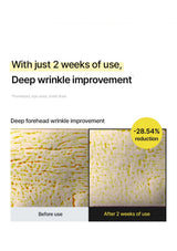 CELIMAX retinal booster — Forehead lines after two weeks