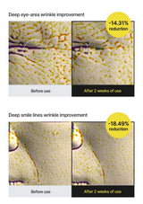 CELIMAX retinal booster — Eye lines and smile lines