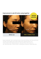 CELIMAX retinal booster — Duo lifting result