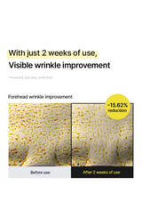 CELIMAX retinol serum — Forehead lines: two weeks
