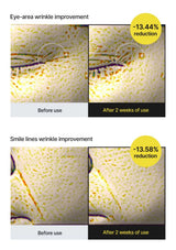 CELIMAX retinol serum — Eye and smile lines