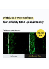CELIMAX retinol serum — Skin density assessment