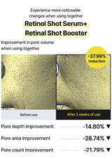CELIMAX Retinol Shot Serum and Retinal Shot Booster: complete pore comparison and pore depth, area and count results after two weeks