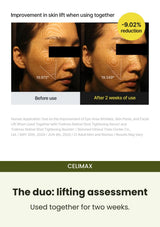 CELIMAX retinol serum — The duo: lifting assessment