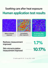 Original infrared-exposure skin measurements with 1.7 percent redness and 10.17 percent microcirculation improvements