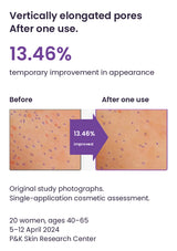 Original vertically elongated pore study photographs with 13.46% temporary improvement after one use