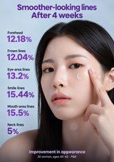 Four-week appearance improvements for forehead, frown, eye, smile, mouth and neck lines
