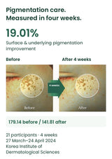 Original pigmentation study images and 19.01% improvement after four weeks