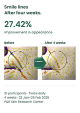 Original smile-line study images and 27.42% improvement after four weeks