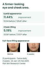 Four-week eyelid and cheek lifting measurements and original full-face study photographs