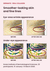 DERMAFIX Real Collagen authentic before-and-after skin-analysis images for eye-area wrinkles and under-eye appearance, before and immediately after one use. Korea Institute of Dermatological Sciences. 23 participants. 31 January–31 March 2020.