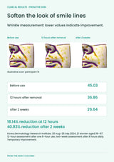 FROM THE SKIN Wrinkle Lifting Patch — Soften the look of smile lines