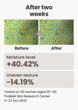 Two-week toner test: moisture increased 40.42 percent and uneven texture decreased 14.19 percent in 20 women aged 20 to 60