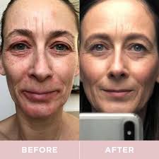 Revive Collagen Enhanced Plus - Hydrolysed Marine Collagen Drink