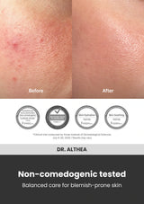 Dr. Althea 345 Relief Cream — Non-comedogenic tested. Balanced care for blemish-prone skin
