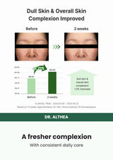 Dr. Althea Gentle Vitamin C Serum 30ml — A fresher complexion. With consistent daily care