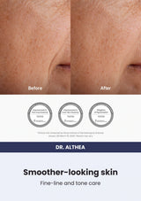 Dr. Althea Pure Retinol 0.15% Cream — Smoother-looking skin. Fine-line and tone care