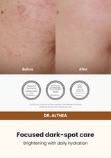 Dr. Althea Vitamin C Boosting Serum 30ml — Focused dark-spot care. Brightening with daily hydration