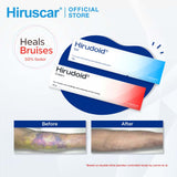 [HIRUSCAR] Hirudoid Gel 40g | Bruise Treatment