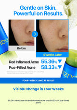 Numbuzin No.0 sulfur cleansing foam four-week clinical result