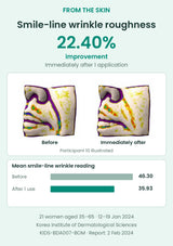 FROM THE SKIN Sun Balm smile-line wrinkle roughness: 22.40% improvement immediately after 1 application. Authentic study images of participant 10, with group mean readings.