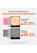 GENABELLE PDRN ampoule clinical redness and texture test results | GENABELLE PDRN 3% Hyper Boost Ampoule gallery 4 of 13
