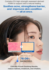 Advertisement for a skincare product showing before and after effects on skin.