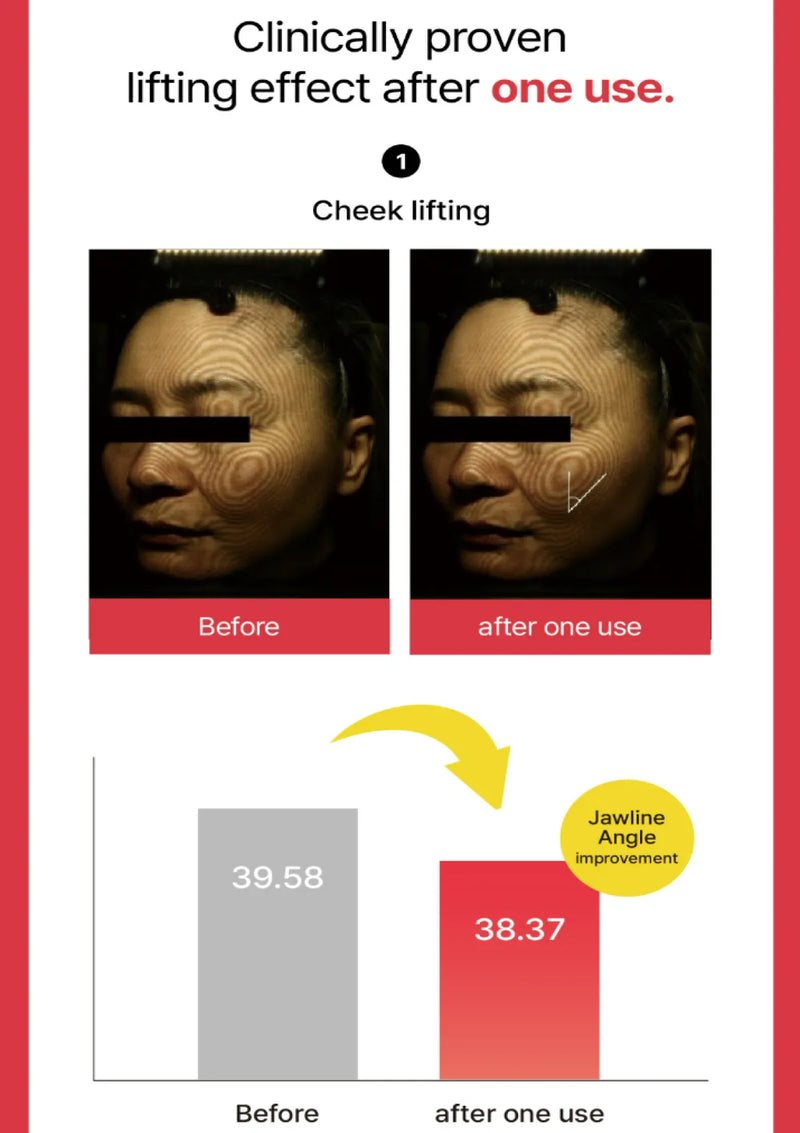 Before and after effects of a skincare product on a person's face, with text indicating clinically proven lifting effect.