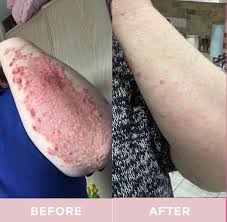 Revive Collagen Enhanced Plus - Hydrolysed Marine Collagen Drink
