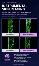 An informational graphic titled 'Instrumental Skin Imaging' with text about objective structure assessment and four small before-and-after skin image panels labeled Baseline Image and Follow-Up Image. The design uses a dark navy background with white and purple text and accents.