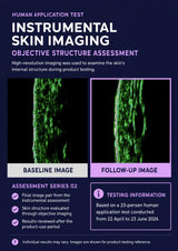An informational poster for an Instrumental Skin Imaging human application test, featuring two vertical skin texture images labeled Baseline Image and Follow-Up Image, with text detailing assessment series and testing information on a dark purple background.