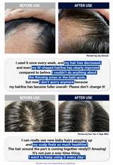 A before-and-after collage showing close-up hair growth results on three different users. The top row shows a hand parting hair in 'BEFORE USE' and 'AFTER USE' views.