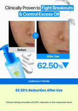 Numbuzin No.0 cleansing jelly 62.50% clinical test result