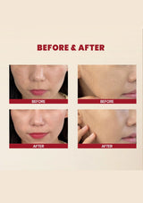 Before and after comparison of facial skin treatment on a beige background with 'Before & After' text.