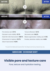 Medicube One Day Exosome Shot Mild 2000 | Strong 7500 (30ml) — Visible pore and texture care