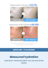 Medicube Hyaluronic Multi Peptide Serum 30ml — Measured hydration