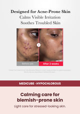 Medicube Hypochlorous Acid Daily Facial Spray 125ml — Calming care for blemish-prone skin