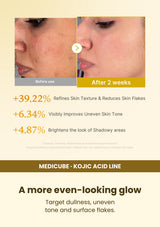 Medicube Kojic Acid Turmeric Toner 250ml — A more even-looking glow. Target dullness, uneven tone and surface flakes.