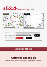Medicube Red Acne Body Peeling Shot Cleanser 110g — Care for excess oil