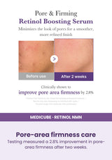 Medicube Retinol NMN Boosting Serum 30ml — Pore-area firmness care