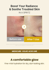 Medicube Kojic Acid Turmeric Jelly Mist 100ml — A comfortable glow. Fine-mist hydration for dry, dull-looking skin.