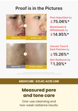 Medicube Kojic Acid Turmeric Peel Shot 80ml — Measured pore and tone care. One-use cleansing and two-week radiance results.