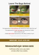Medicube Kojic Acid Turmeric Eye Serum 30ml — Measured eye-area care. Puffiness after one use; dark circles after two weeks.