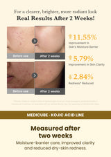 Medicube serum two-week test results: moisture barrier, skin clarity and dryness-related redness