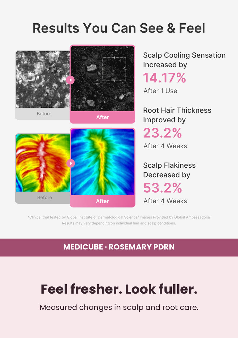 Medicube Rosemary PDRN Scalp Serum — Feel fresher. Look fuller. Measured changes in scalp and root care.