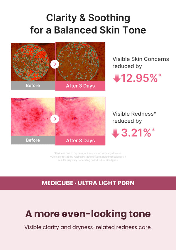 Medicube Ultra Light PDRN Pink Peptide Serum 30ml — A more even-looking tone. Visible clarity and dryness-related redness care.