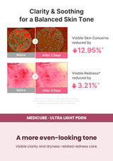 Medicube Ultra Light PDRN Pink Peptide Serum 30ml — A more even-looking tone. Visible clarity and dryness-related redness care.