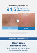 Medicube zero pore blackhead deep cleansing oil 205ml — Clean pores. Refreshed skin. Pore impurities reduced by 94.5% immediately after one use.